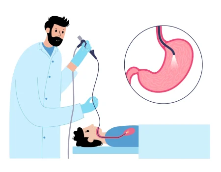 59166963_gastroscopy_30