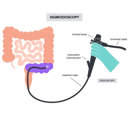 73729514_endoscopy_5_1_15